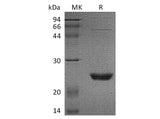 Recombinant Human UBE2M/UBC12 Protein Expression Host E.coli