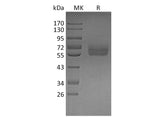 Recombinant Human TYRO3 Protein (His Tag)