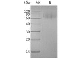 Recombinant Human MERTK/MER Protein (His Tag)