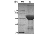 Recombinant Human TROP2/TACSTD2 Protein (Fc Tag)