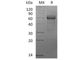 Recombinant Human TNFRSF1B/CD120b Protein (mFc Tag)