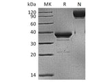 Recombinant Human BCMA/TNFRSF17 Protein (mFc Tag)