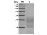 Recombinant Human BCMA/TNFRSF17 Protein (His Tag)