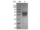 Recombinant Human TRAIL R4/TNFRSF10D Protein (Fc Tag)