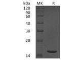 Recombinant Human TNF-alpha/TNFA Protein (Active)