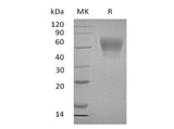 Recombinant Human TPBG/5T4 Protein (His Tag)