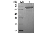 Recombinant Human TPP1/CLN2 Protein (His Tag)