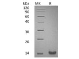 Recombinant Human Trefoil Factor 1/TFF1 Protein (His Tag)