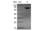 Recombinant Human Transferrin Receptor/TFRC Protein (His Tag)