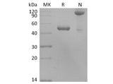 Recombinant Human BLyS/TNFSF13B/BAFF Protein (Fc Tag)