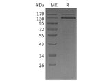 Recombinant Human Thrombospondin-1/THBS1 Protein (His Tag)(Active)