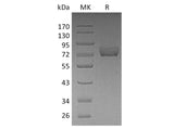 Recombinant Human Thrombomodulin/CD141 Protein (His Tag)