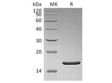 Recombinant Human FGF-2/FGF basic/FGFb Protein (aa 1-155)(Q65I,C96S,N111G)