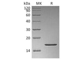 Recombinant Human FGF-2/FGF basic/FGFb Protein (aa 1-155, Lus128Asn)