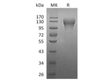 Recombinant Human CD96 Protein (His Tag)(Active)