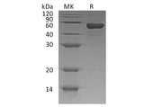 Recombinant Human CD4/LEU3 Protein (His Tag)