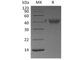 Recombinant Human TIM-3/HAVCR2 Protein (His Tag)(Active)