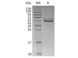 Recombinant Human TIGIT Protein (Fc Tag)