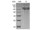 Recombinant Human TIM4/TIMD4 Protein (His Tag)