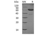 Recombinant Human CD7/GP40 Protein (Fc Tag)