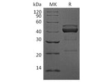 Recombinant Human TIGIT Protein (mFc Tag)