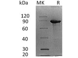 Recombinant Human Syndecan-1/SDC1 Protein (Fc Tag)