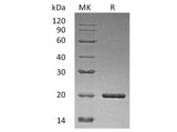 Recombinant Human Sonic Hedgehog/SHH Protein (Active)