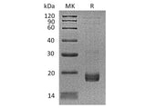 Recombinant Human Troponin C/TNNC1 Protein (His Tag)