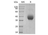 Recombinant Human SLAMF6/Ly108 Protein (aa 28-225, His Tag)(Active)