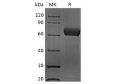 Recombinant Human CD48 Protein (mFc Tag)