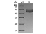 Recombinant Human SIRPB1/CD172b Protein (His Tag)