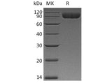 Recombinant Human CD172a/SIRPA Protein (mFc Tag)