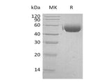 Recombinant Human CD172a/SIRPA Protein (His Tag)(Active)