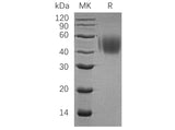 Recombinant Human CD150/SLAMF1 Protein (His Tag) Purity >95%