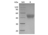 Recombinant Human CD24 Protein (Ser27-Gly59,Ser44Thr)(Fc Tag)