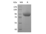 Recombinant Human SIGLEC5 Protein (His & Flag & Fc)