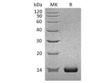 Recombinant Human SAA2/Serum Amyloid A2 Protein (His Tag)