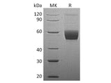 Recombinant Human Vaspin/SerpinA12 Protein (His Tag)