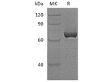 Recombinant Human Vaspin/SerpinA12 Protein (GST Tag)