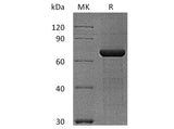 Recombinant Human Semaphorin 3A/SEMA3A Protein (His & Flag Tag)