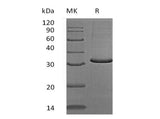 Recombinant Human SCGN/Secretagogin Protein (Human Cells, His Tag)