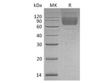 Recombinant Human LIMP-2/LIMPII Protein (His Tag)