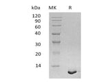 Recombinant Human S100A12/CAGC Protein