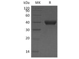 Recombinant Human RNASET2 Protein (Human Cells, His Tag)