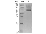 Recombinant Human Renin Protein (His Tag) Expression Host HEK293 Cells