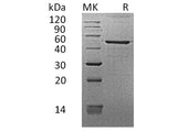 Recombinant Human REG3G/PAP-1B Protein (Fc Tag)