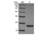 Recombinant Human REG1A/PSPS Protein (His Tag)