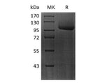 Recombinant Human FLT-3/FLK-2 Protein (Fc Tag)