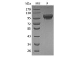 Recombinant Human HER4/ErbB4 Protein (His Tag)