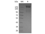 Recombinant Human PSGL-1/CD162 Protein (Fc Tag)